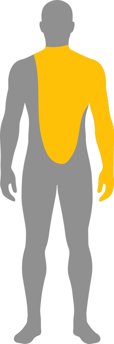 Areas where pain is most likely felt